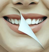 Sonrisa pasando página antes y después